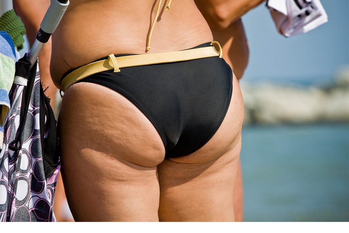 Adonis-Body-Tite-liposukcija-uvodna